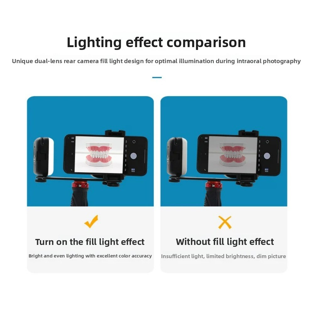 Dental Photography Light, Blue - đánh giá và giá Photography Basic